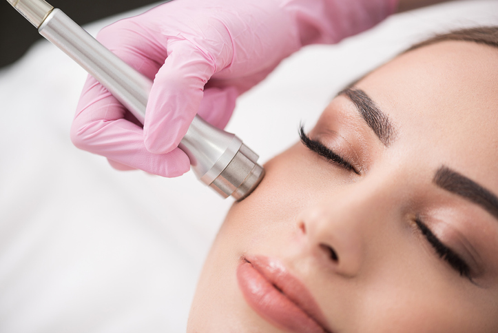 microdermabrasion Microdermabrasion im Gesicht